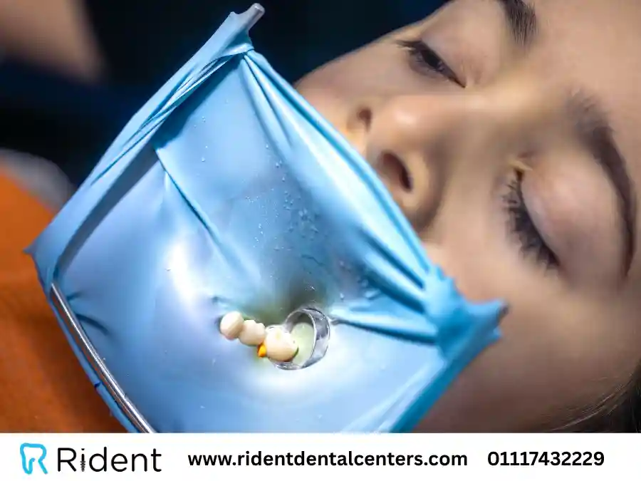 تعرف على اسعار حشو الاسنان